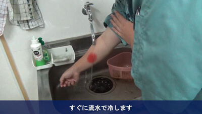 やけど　イメージ1